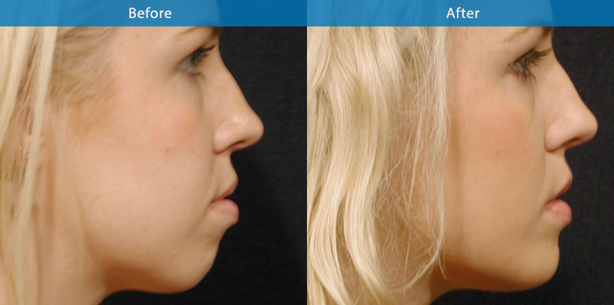 <h3>Case 1</h3><p></p>