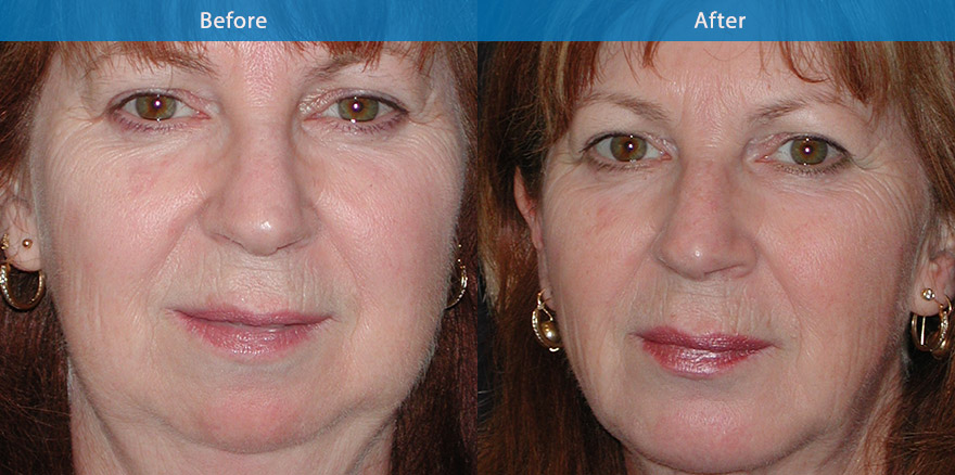 <h3>Case 2</h3><p></p>