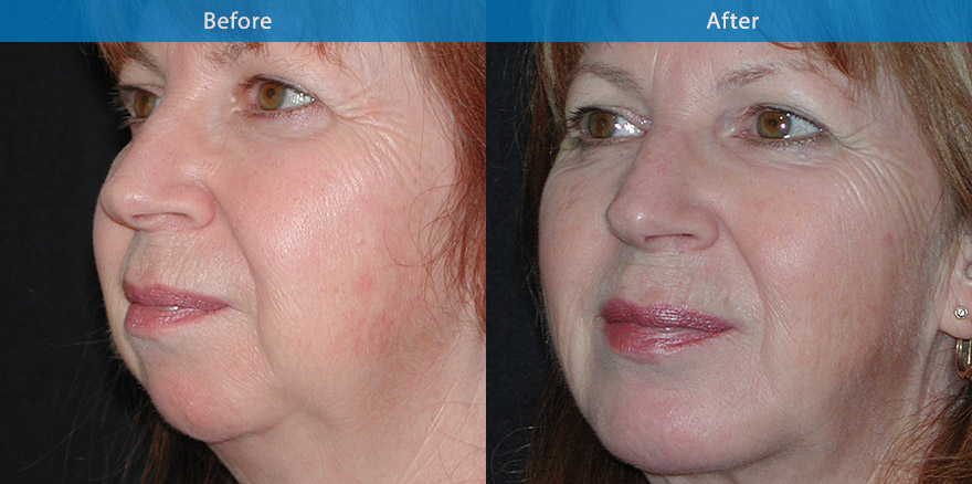 <h3>Case 4</h3><p></p>