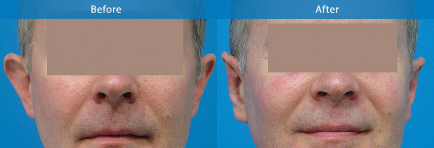 <h3>Case 1</h3><p></p>